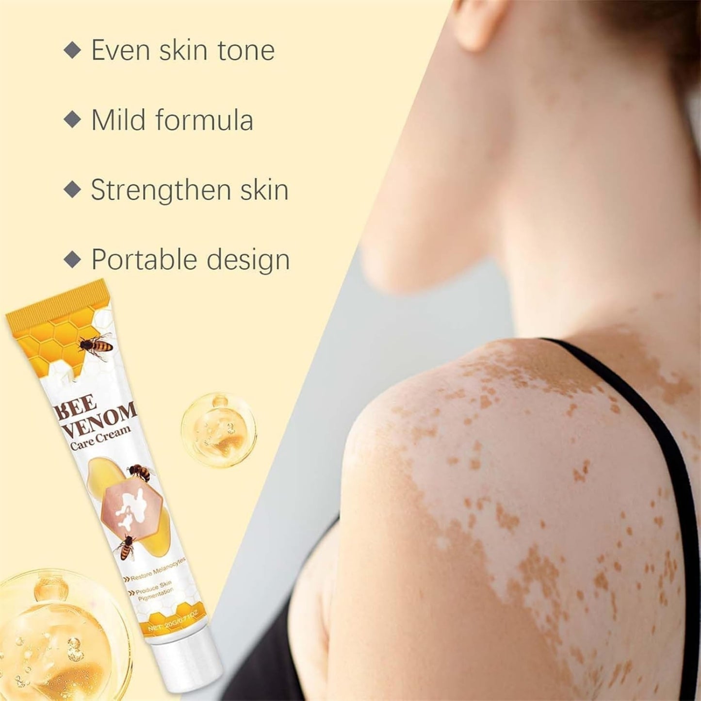 Vitigo Bee Venom Treatment Cream | Natural Skin Repair Hydration Relief Anti-Irritation